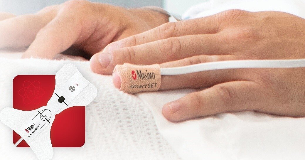 Masimo's smartSET gains FDA clearance for AFib detection on Radius VSM